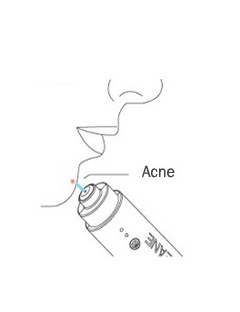 CLEANE® Light Therapy: traitement de l'acnée